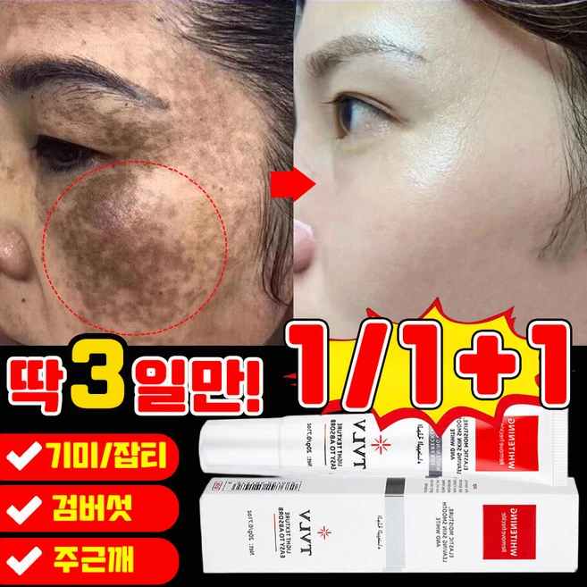 [국내배송] 1/1+1 기미 크림 잡티 검버섯 주근깨 제거 멜라토닝 멜라논 크림 화이트닝 스팟 색소침착 미백 앰플, 2개, 20g - 쿠팡