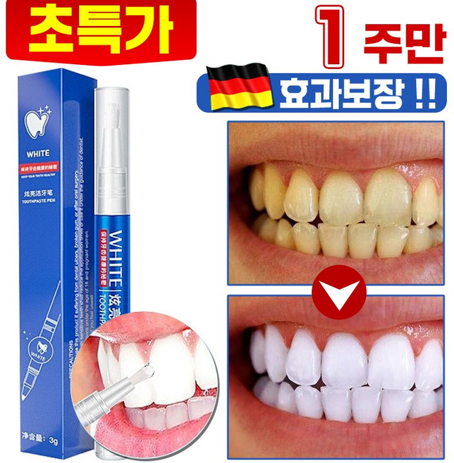 1/1+1 화이트닝 셀프 치아 치아미백 펜 겔 구강 위생 입냄새 누렁니 얼룩 제거, 1개, 3g