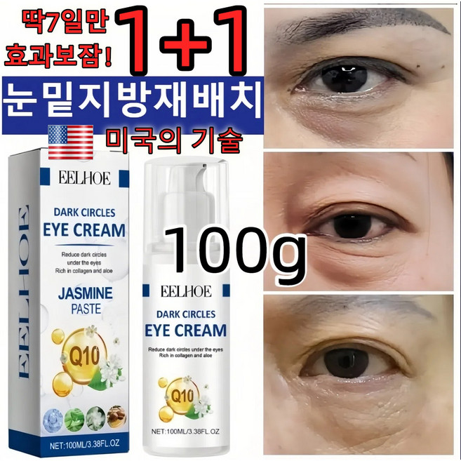 아이백리프트 아이백크림 눈밑지방 다크서클크림 눈밑지방재배치 아이백크림 아이백리프트 눈밑지방제거, 2개, 100g