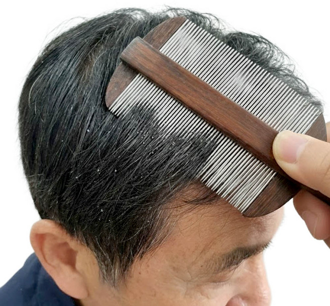 깔끔더하기 머릿니 제거 참빗 스테인리스 머리빗, 1개, 우드