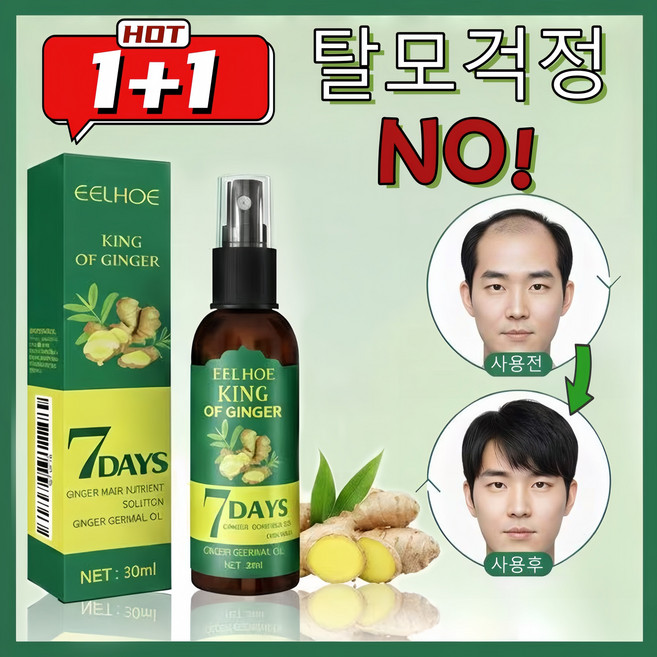 미국기술 1/1+1/2+2 두피 영양제 머리 발모제 모발 성장 촉진 에센스 탈모 방지 완화 두피케어 세럼 포장증정, 1개, 30ml
