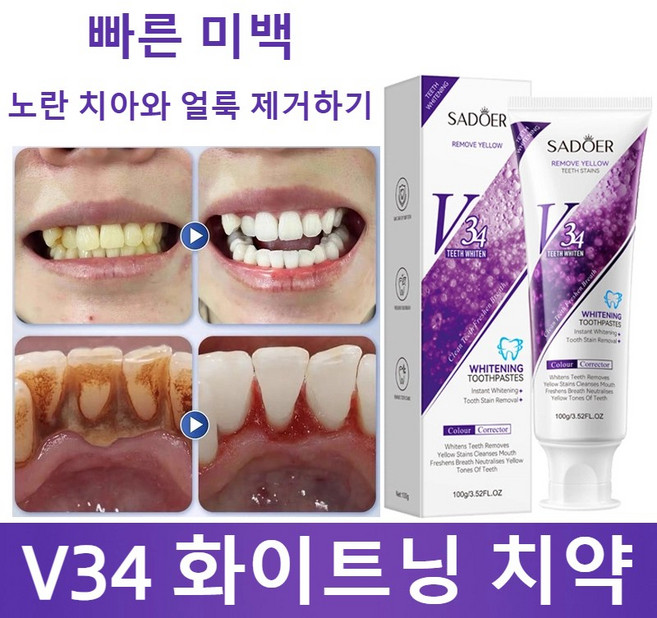 2+1/3+2 V34 미백치약 누런치 제거 입냄새 제거 더러움 제거 치석 제거 미백 치아 누렁니미백치약, 1개, 100g