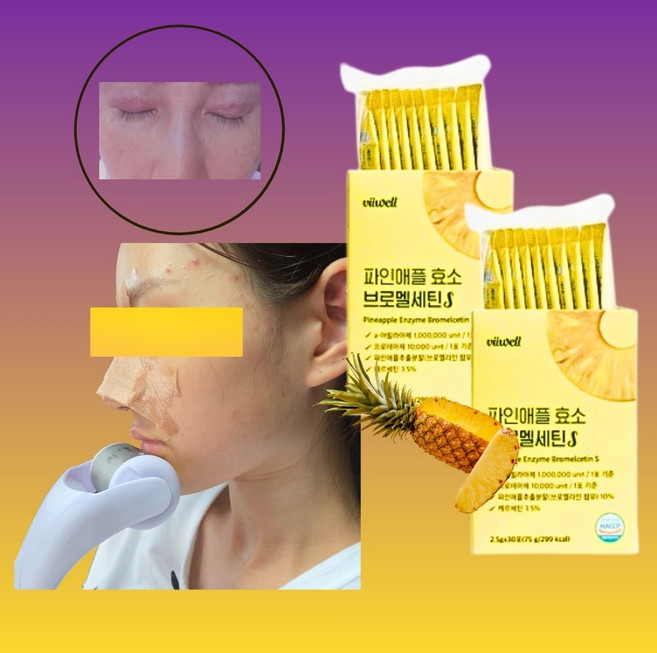 붓기빼 브로멜라민 눈 코 성형후 얼굴 붓기 효소 2달치 역가수치, 1박스, 60회분