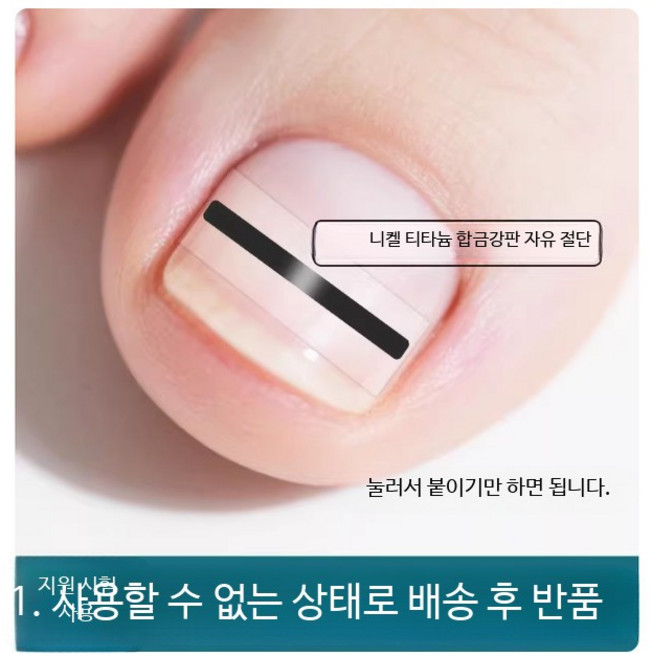 교정기 아랫니 장치 임시치아 수면 얼굴 포지셔너 리테이너 커버 앞니 어린이 1단계부드러움 입꼬리 코골이방지 발톱교정 내성발톱 1단계부드러움 세트당 않는 고무 도구 1단계 진동, 5개
