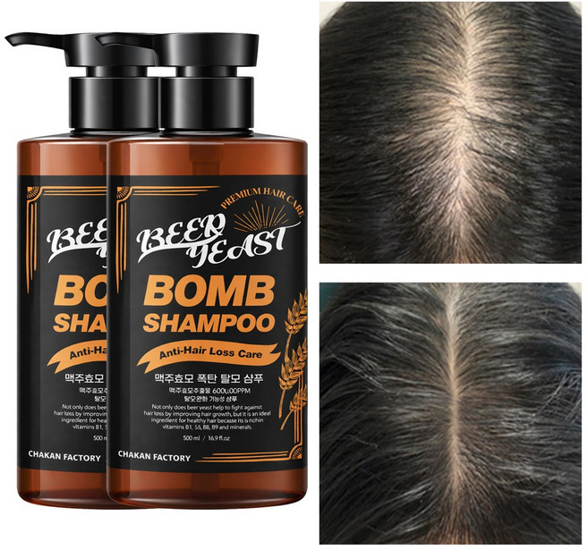 탈모샴푸 약산성 두피 맥주효모 탈모 완화 비오틴 바이오틴 남자 여자 샴푸 볼륨, 2개, 500ml