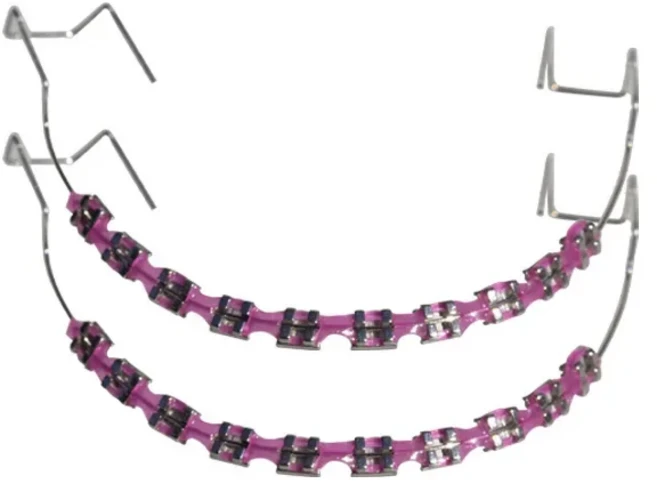 패션 교정기 1 쌍 금속 와이어와 다채로운 임시 치아 장식 브래킷 합자 관계