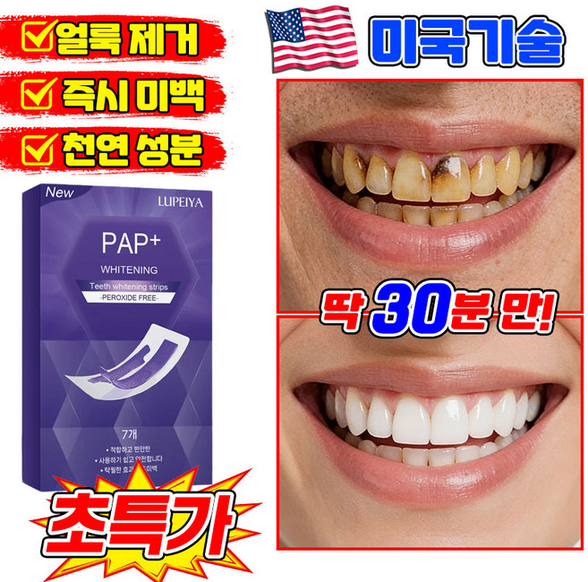 [즉시 미백] V34 치아미백 테이프 치아 보색 테이프 치아미백 패치 치아미백제 미백 스트랩 누렁니 얼룩 제거 포장 증정 LUPEIYA, 1개