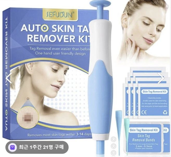 쥐젓제거기 스킨태그 제거펜 고무밴드 방식 셀프 피부관리, 1개, 블루 - 쿠팡