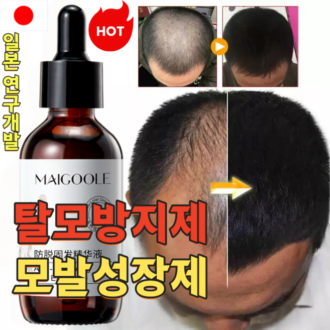 탈모 예방 영양제 탈모 증상 완화 남녀 공용 순하고 자극 없음 탈모 방지 헤어 에센스 모발 성장 촉진 두피 영양 케어 에센스 모발성장 오일, 2개, 60ml