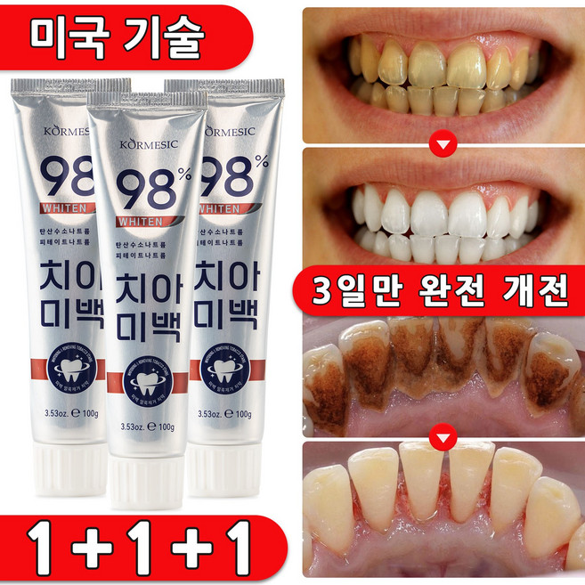 [당일 배송] 치약 휴대용 미백 대한민국 판매1위 치약 추천 1 위 치약 치약 불소치약 추천 1 위, 3개, 100ml