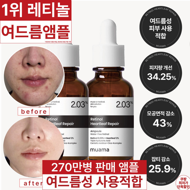 3일 여드름 순삭 진정 모공면적감소 피지감소 임상완료 [270만병 판매기념 할인] 고함량 레티놀 어성초 히알루론산 나이아신아마이드 뮤아마 앰플, 2개, 30ml