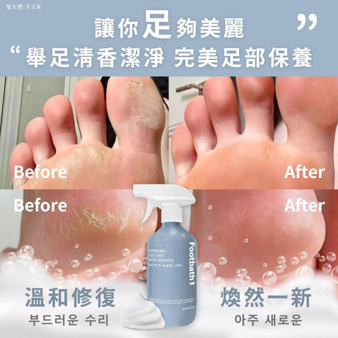 Footbath 銀離子足部泡泡清潔噴霧, 1個