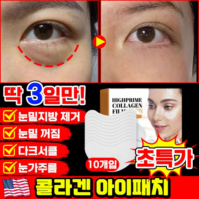 [당일출고 | 국내배송] 1/1+1/2+2 콜라겐 아이패치 눈밑 지방제거 패치 눈가주름 패치 다크서클 눈밑꺼짐 제거 아이팩 아이백 리프팅 아이케어 LUPEIYA, 1개, 10개입