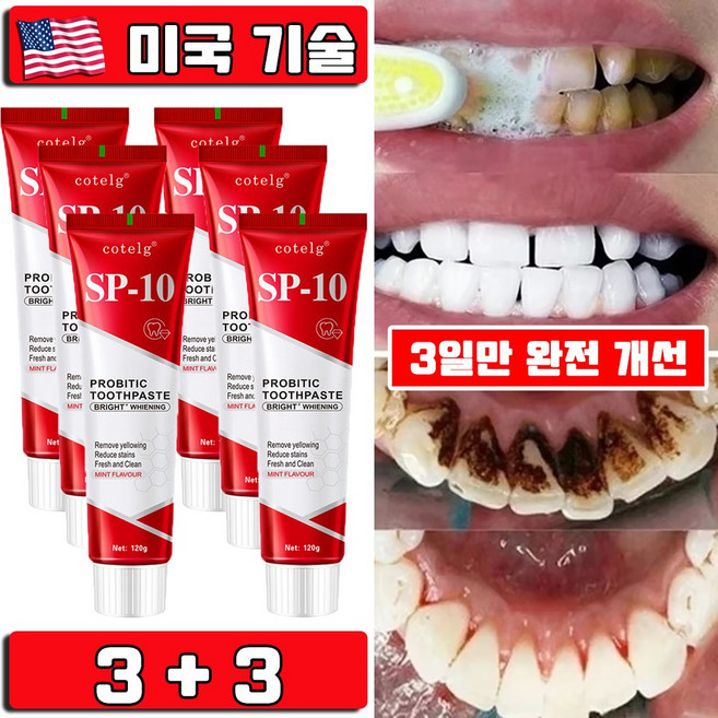 미국 1/1+1 SP10 미백 치약 누렁니 제거 입냄새 제거 프로바이오틱 화이트닝 미백 치약 치아미백 대용량 프리미엄 사은품 랜덤 증정, 6개, 120g