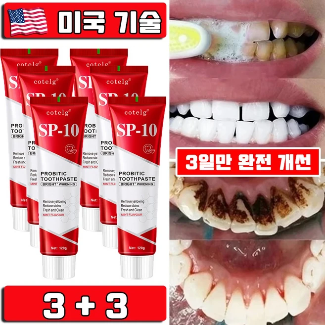 미국 1/1+1 SP10 미백 치약 누렁니 제거 입냄새 제거 프로바이오틱 화이트닝 미백 치약 치아미백 대용량 프리미엄 사은품 랜덤 증정, 6개, 120g - 쿠팡