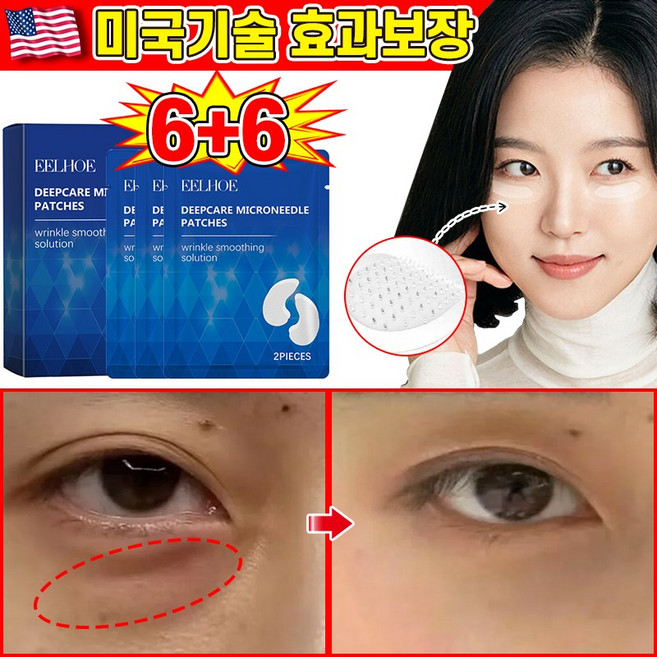 [빠른효과] 아이백 리프트 1100샷 리들 패치 눈밑 지방제거 아이 패치 히알루론산 눈가 리프팅 니들샷 다크써클 니들 패치 눈밑주름 패치 브라이티닝 LUPEIYA 포장증정, 2개, 6개입