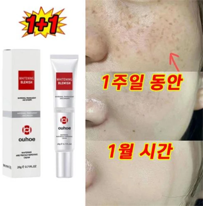 [랜덤 선물]색소침착연고 검버섯 기미 여드름 미백 크림 색소침착 다크 스팟 제거 얼굴 미백 크림, 20g, 6개 - 쿠팡