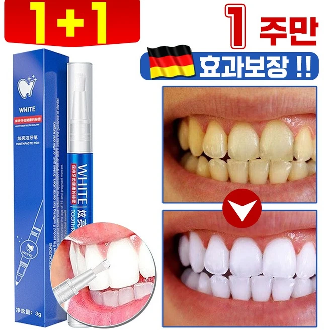 독일개발 화이트닝 셀프 치아 미백제 치아 미백 펜 겔 구강 위생 케어 입냄새 누렁니 얼룩 제거 프리미엄 3g, 2개 - 쿠팡