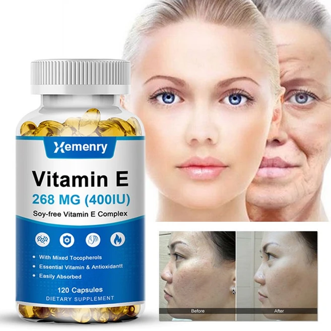비타민 E 캡슐은 천연 항산화제로서 피부와 면역 체계를 지원하고 피부 모발 손톱 면역력 및 눈 건강을 증진합니다., 1개, 30정 - 쿠팡