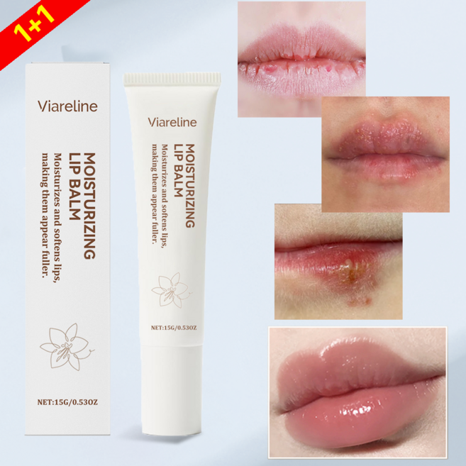대용량 립에센스 입술포진 헤르페스 구순물집 입술 각질제거 입술 립밤 립케어 전용 각질관리 립크림 입술보습제 립밤에센스 보습 립밤, 2개, 20g, 무색