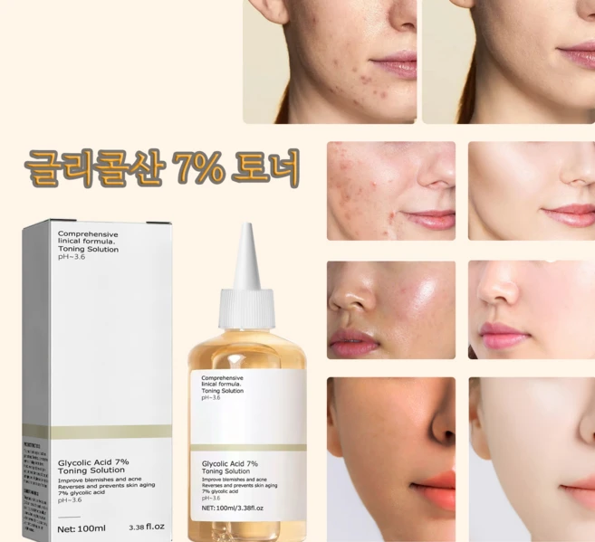 글리콜산7% 산성토너 각질제거 보습 건조방지, 1개, 240ml - 쿠팡