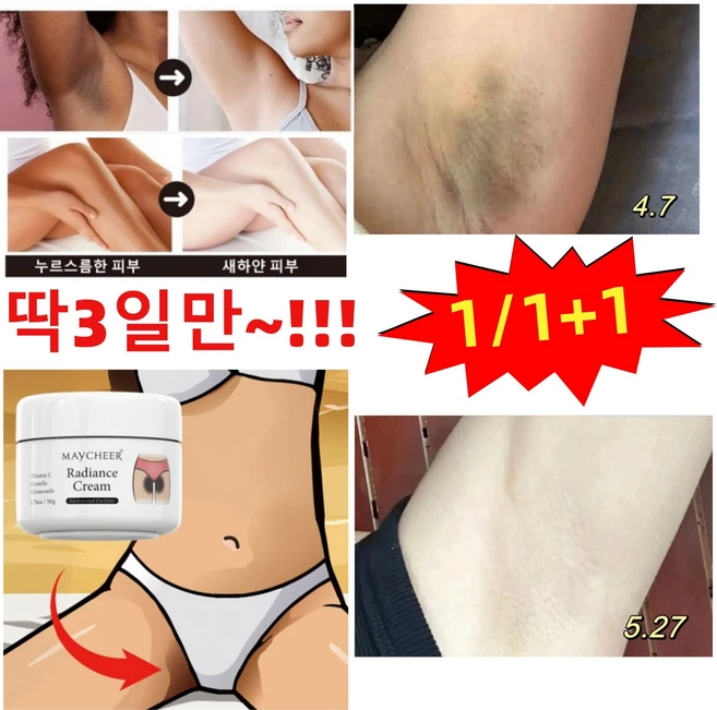 겨드랑이 색소침착 색소침착연고 멜라닌 제거 멜라닌 억제 팔꿈치 무릎 사타구니 미백 크림, 1개, 50g - 쿠팡