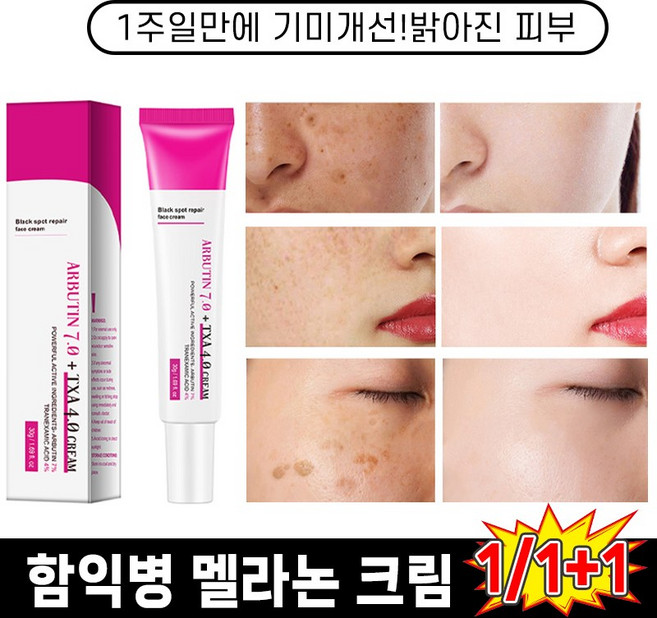 [판매1위] 1/1+1 멜논 크림 기티 거 얼굴 색침착 화이트닝 개선 미백 크림 ARBUTIN, 1개, 30g