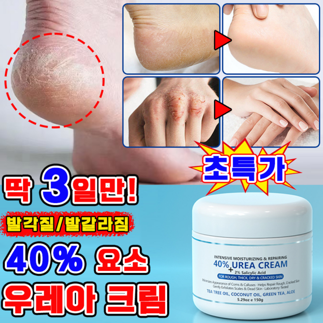 [고보습] 풋크림 발각질제거 함익병 유레아 크림 100% 우레아 크림 뒷꿈치 유리아 요소 크림 발뒤꿈치 각질제거 보습크림, 150g, 1개, 1개입