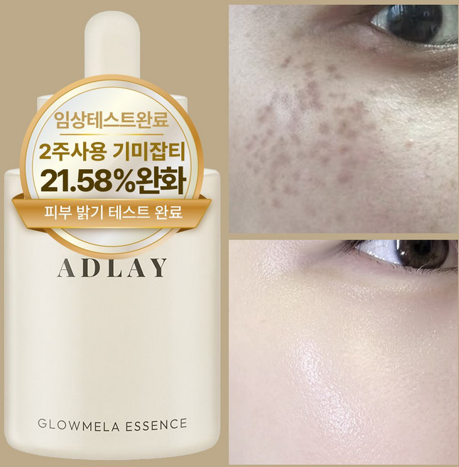 아들레이 화이트닝 색소침착 기미 미백 에센스 앰플, 1개, 50ml