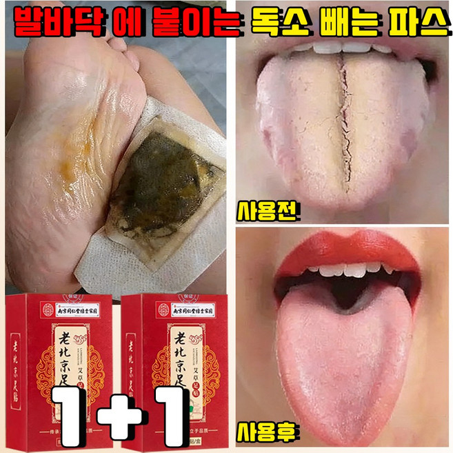 [한방 습기 제거] 발바닥 파스 발바닥 패치 발바닥 에 붙이는 독소 빼는 파스 발패치 한방 파스 풋패치 발팩 피로회복 목초수액 노부경발패치 HANFEN 사은품 랜덤 증정, 50개입, 2개