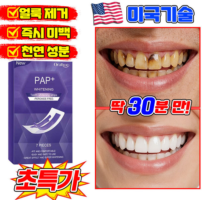 [즉시 미백] V34 치아미백 테이프 치아 보색 테이프 치아미백 패치 치아미백제 미백 스트랩 누렁니 얼룩 제거 포장 증정, 1개