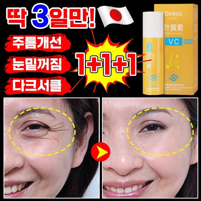 [3일만 효과보장] 1+1 루테인 VC 아이 리프팅 롤러 세럼 눈가주름 눈밑꺼짐 다크서클 아이크림 눈밑지방 제거 크림 포장 랜덤 출고, 3개, 8ml