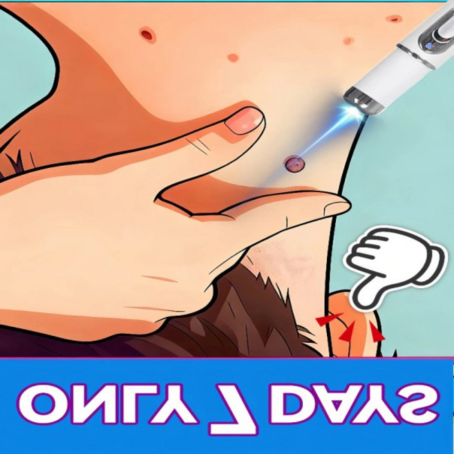 25HTND 세대 업그레이드된 점 제거제 ⸴ 점 제거 ⸴ 빠르게 OP, 02 1pcs