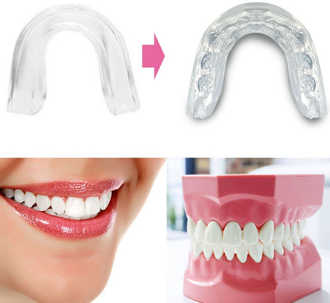 형상기억 마우스피스 가드 이악물기 치아 맞물림 마찰, 1개