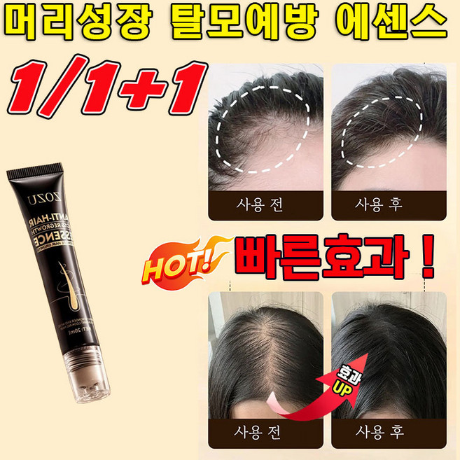 [오늘특가] 탈모 앰플 M자모발전문케어 블랙 성장 강화 모발관리 두피에센스 수염/눈썹/두피 양양제, 1개, 20ml