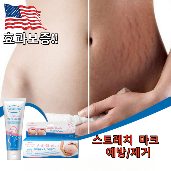 CARVENCHY 튼살 크림 임산부크림 임산부 전용 안전하다 부담제로, 3개, 60ml