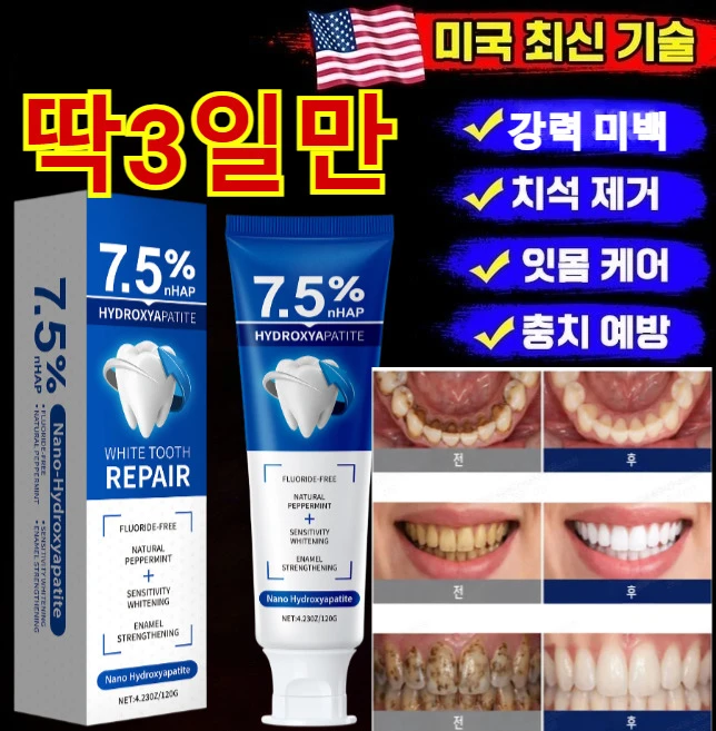 [강력 미백+잇몸 재생]7.5% 하이드록시아파타이트 치약 미백치약 이빨 염증 케어 개선 예방 통증 완화 냄새 얼룩 제거, 2세트 - 쿠팡