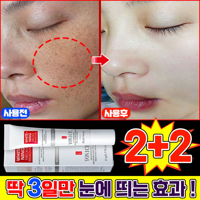 {국내배송 | 100% 효과있음} 1/1+1/2+2 기미크림 기미 잡티 주근깨 검버섯 제거 크림 색소침착 미백 크림 들깨기미크림 화이트닝 LUPEIYA, 4개, 20.01g