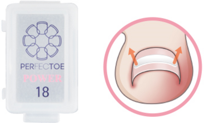 퍼펙토 베이직글루7g 내성발톱 파고드는발톱 테이프 부착글루, 파워리필팁18mm, 1개