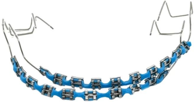 트렌디한 교정기 주얼리 세트 2개 | 화려한 치아 교정기 반짝이 체인 | 소녀 및 청소년을 위한 치아 교, 05 Light Blue