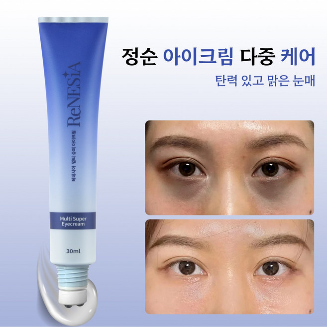 눈밑지방 아이백 리프팅 3200샷 아이크림 동안크림 팔자 눈가 목 주름 영양 탄력 리프팅 눈밑지방재배치 눈밑지방제거 다크서클 눈밑주름 유쎄라블리프팅900샷, 30g, 1개