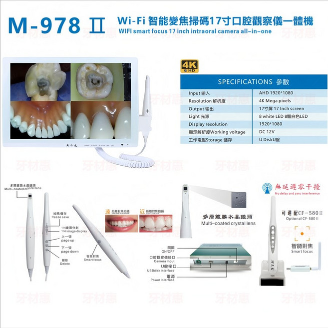 치과 스캐너 구강 진료용 디지털 내시경 고화질 USB구강카메라 카메라 무선, 03.17인치 4K HD 내시경(브래킷포함), 1개