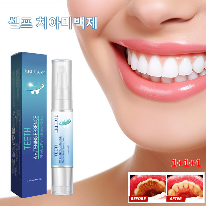 [독일 기술] 치아 미백겔 셀프치아미백 구강 위생 클렌징 화이트닝 누렁니 얼룩 제거 셀프 치아미백제, 3개, 4ml