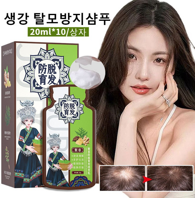 진저 포뮬라 샴푸 발모 생강 탈모방지샴푸 남녀 공용 모발 가려움증과 비듬 제거 두피케어 린스 샴푸, 2개, 20ml*10/상자