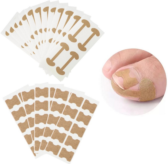 바이유즈 내성발톱 자가관리 2종 테이프밴드, 1세트