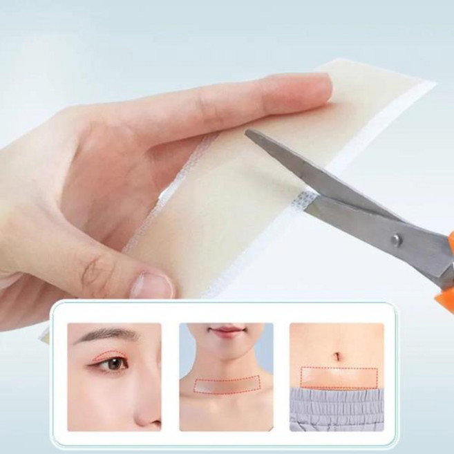 실리콘 신생아 귀 교정기 미적 돌출 패치 스티커 교정 테이프