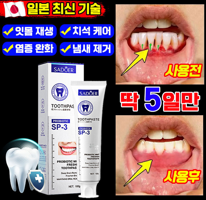 [효과 보장]잇몸 재생 치약 잇몸치약 약국 전용 잇치 치약 치주염 잇몸붓기 이빨 염증 케어 개선 예방 통증 완화 냄새 얼룩 제거 포장 증정, 1개, 100g