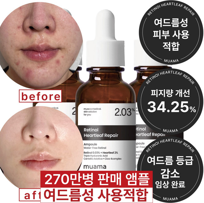 여드름성 피부 사용 적합 사춘기 트러블 진정 개선 흉터 모공감소 피지연화 5종 임상완료 [누적 270만병] 고함량 나이아신아마이드 레티놀 어성초 히알루론산 뮤아마 앰플 세럼, 3개, 30ml