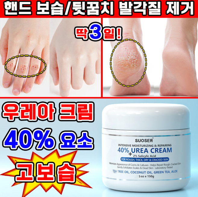 고보습 풋크림 유리아 크림 함익병 유레아 크림 100% 우레아 풋크림 발각질제거 연화제 발 뒷꿈치 보습크림, 1개, 150ml