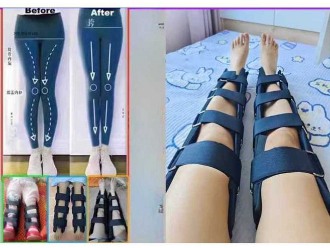 켈리 다리교정 교정기 무릎 휜다리 오다리교정, 1개, 블랙 XXS 신장 60-70cm 원 사이즈